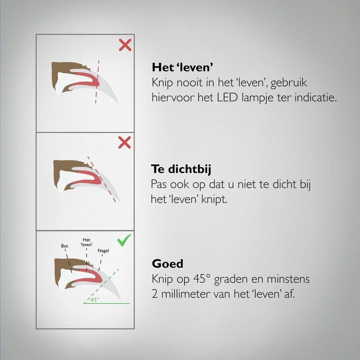 Professionele Oplaadbare LED Licht Nagelknipper, Hond, Kat, Knaagdier, Huisdieren | Dog, Cat, Nail Clipper LED Light, Rechargeable, USB Kabel | Nagelvijl - Nagelschaar Met Vijl, Opvang Van Nagels | Vergrootglas 5x | Extreem Veilig & 100% Effectief 5 Professionele Oplaadbare LED Licht Nagelknipper, Hond, Kat, Knaagdier, Huisdieren | Dog, Cat, Nail Clipper LED Light, Rechargeable, USB Kabel | Nagelvijl - Nagelschaar Met Vijl, Opvang Van Nagels | Vergrootglas 5x | Extreem Veilig & 100% Effectief - Afbeelding 5